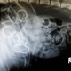 Illustration for article titled 5 X-Rays That Reveal The Craziest Things Pets Have Ever Swallowed